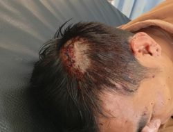 Unit Reskrim Polsek Pagelaran Cianjur Buru Para Pelaku Penganiayaan Pria Berinisial H