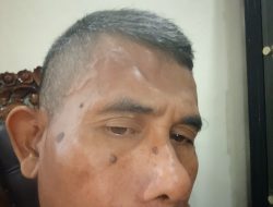 Hasil Penelusuran Miras Ilegal Wartawan Jadi Korban penganiayaan, Pengeroyokan Di Wilayah Kramatwatu Serang Banten